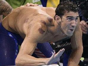 拔火罐吃瓜,夏日养生新风尚